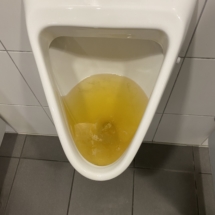 Verstopfung Urinale
